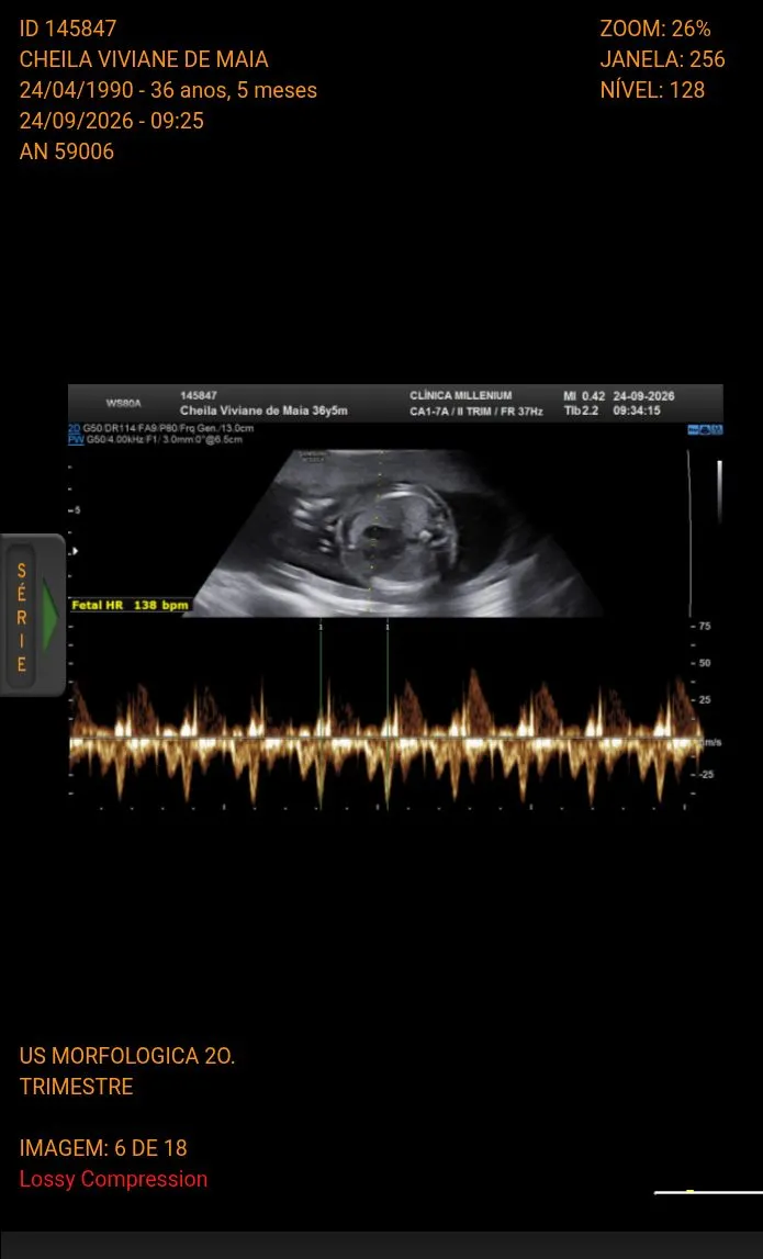 Você acredita em milagre, esse bebê é a sexta gestação que está , teu médico olha para você e diz mamãe está tudo perfeitinho com você e com o bebê na gestação sem tomar nada ..